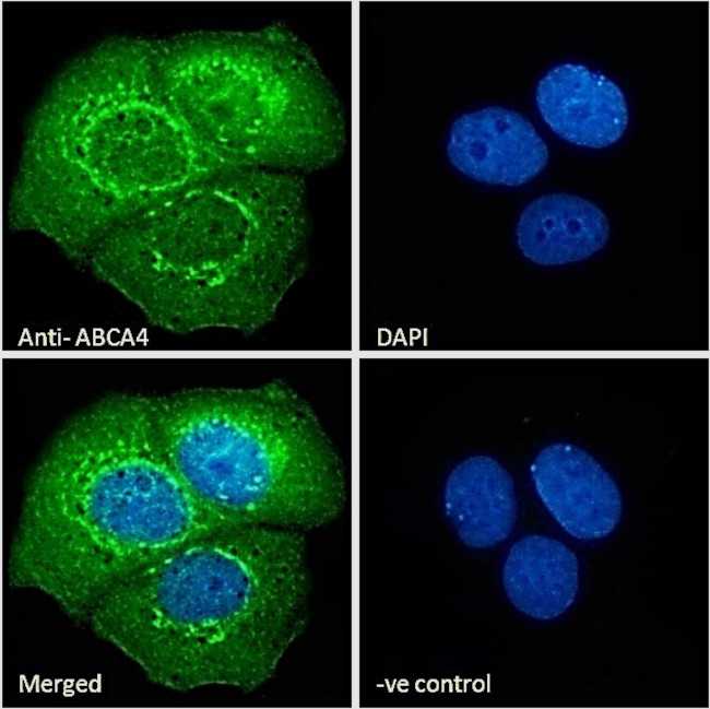 ABCA4 Antibody in Immunocytochemistry (ICC/IF)