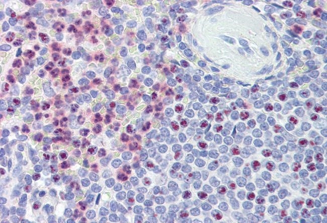 Polycystin 1 Antibody in Immunohistochemistry (Paraffin) (IHC (P))