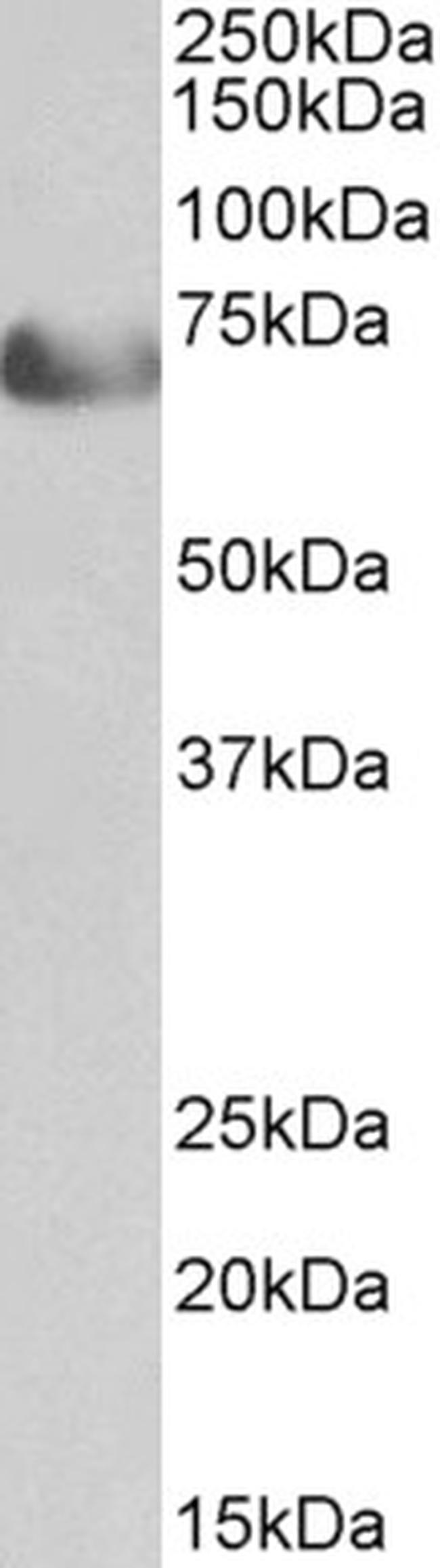 TCF4 Antibody in Western Blot (WB)