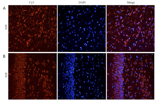 CHRNA7 Antibody in Immunohistochemistry (Paraffin) (IHC (P))