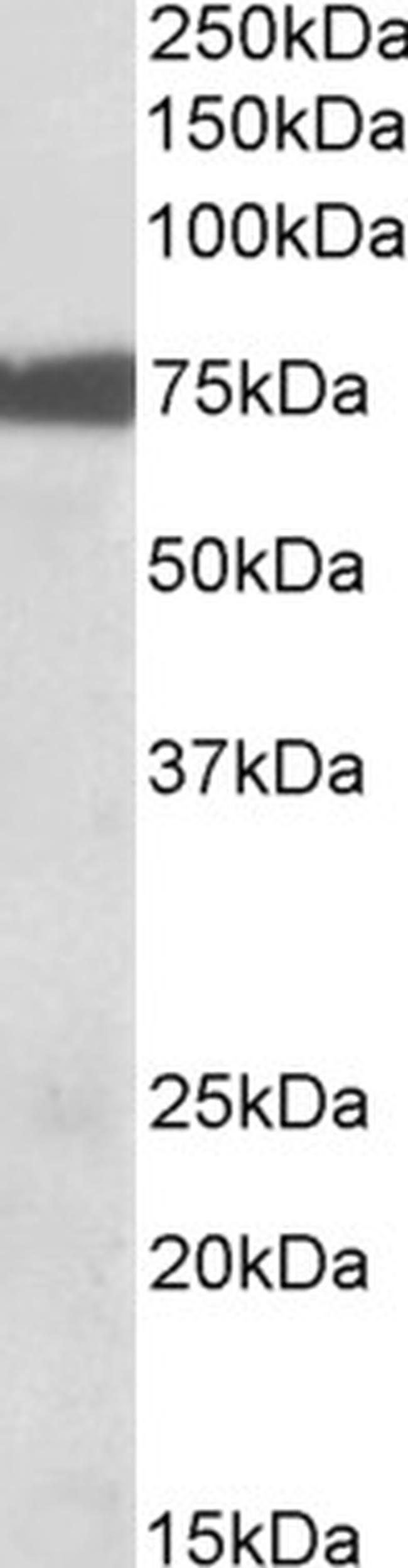 RSK3 Antibody in Western Blot (WB)