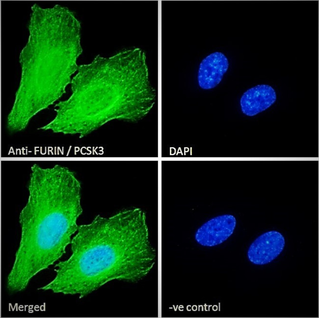 Furin Antibody in Immunocytochemistry (ICC/IF)