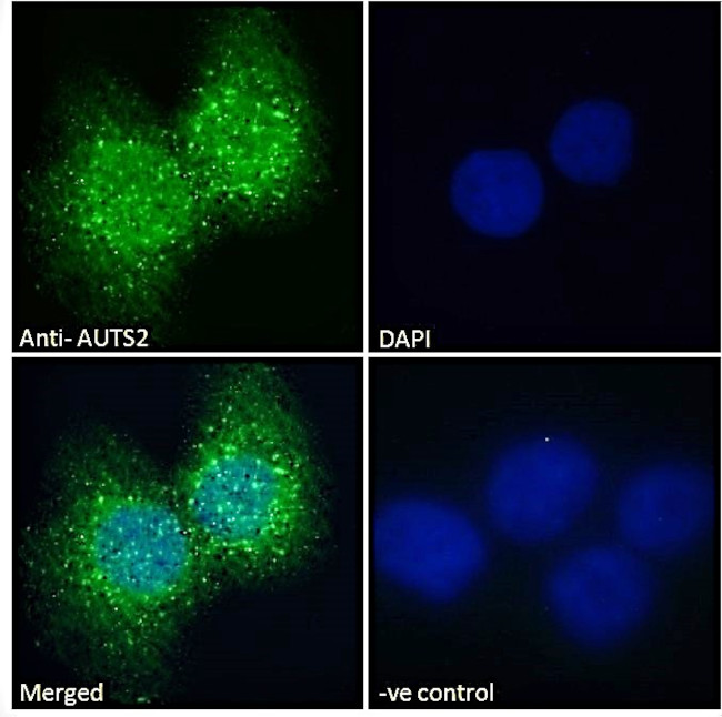 AUTS2 Antibody in Immunocytochemistry (ICC/IF)