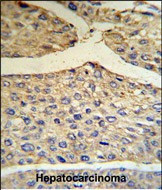 Complement Factor B Antibody in Immunohistochemistry (Paraffin) (IHC (P))