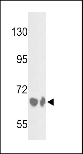 Complement Factor B Antibody in Western Blot (WB)