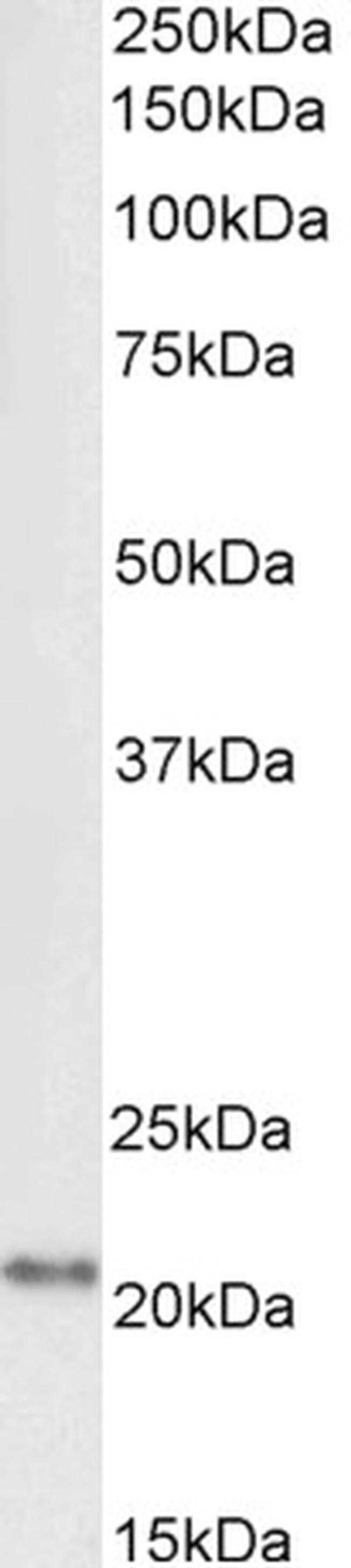 Ferritin Light Chain Antibody in Western Blot (WB)