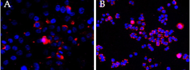 CEP290 Antibody in Immunocytochemistry (ICC/IF)