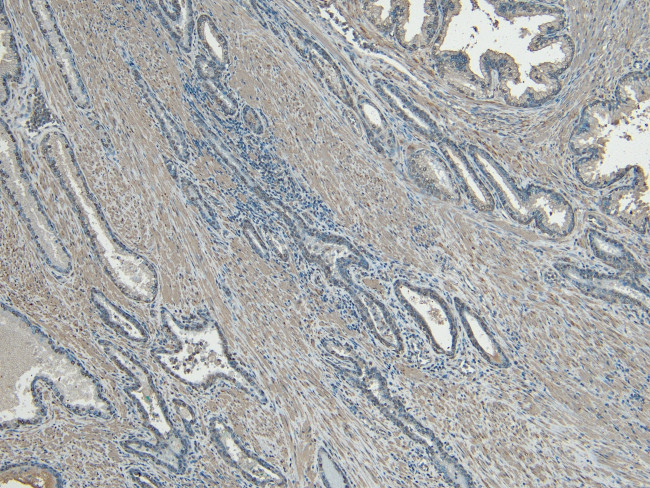 CEP290 Antibody in Immunohistochemistry (Paraffin) (IHC (P))