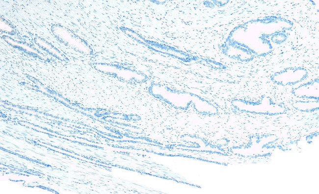 CEP290 Antibody in Immunohistochemistry (Paraffin) (IHC (P))