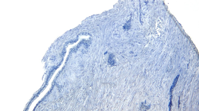 ROR1 Antibody in Immunohistochemistry (Paraffin) (IHC (P))