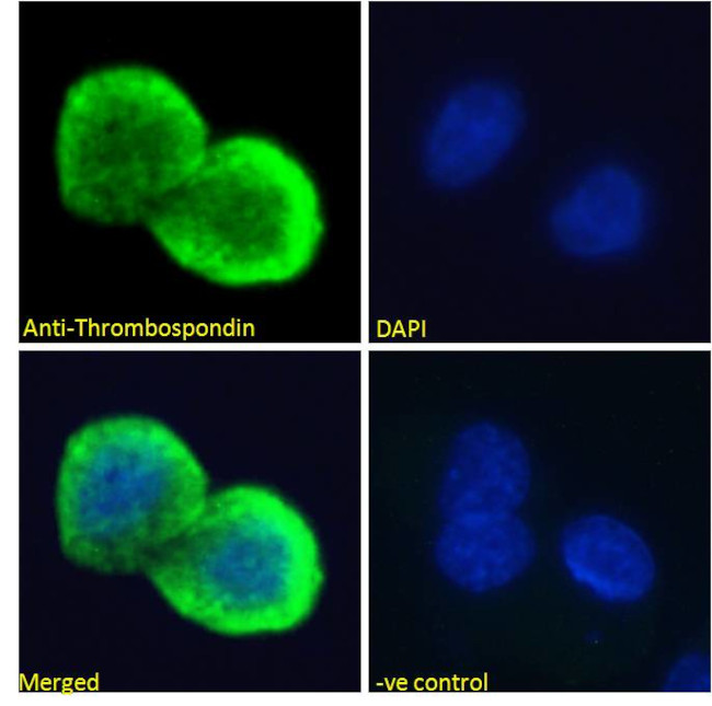 Thrombospondin 1 Antibody in Immunocytochemistry (ICC/IF)