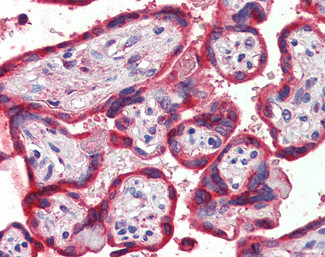 Thrombospondin 1 Antibody in Immunohistochemistry (Paraffin) (IHC (P))