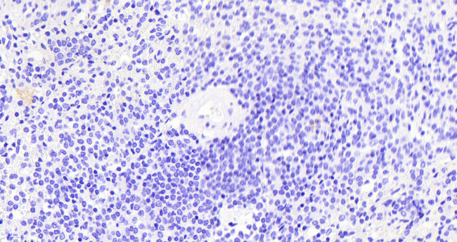 Thrombospondin 1 Antibody in Immunohistochemistry (Paraffin) (IHC (P))