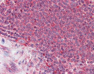 Thrombospondin 1 Antibody in Immunohistochemistry (Paraffin) (IHC (P))