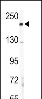 COL5A2 Antibody in Western Blot (WB)