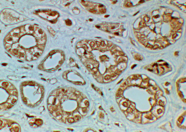 FZD4 Antibody in Immunohistochemistry (Paraffin) (IHC (P))