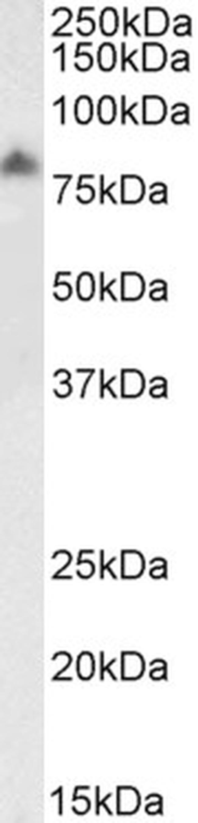 LIMP2 Antibody in Western Blot (WB)