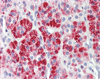 Clathrin Heavy Chain Antibody in Immunohistochemistry (Paraffin) (IHC (P))