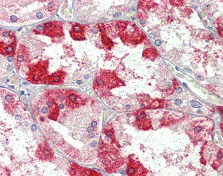 Clathrin Heavy Chain Antibody in Immunohistochemistry (Paraffin) (IHC (P))