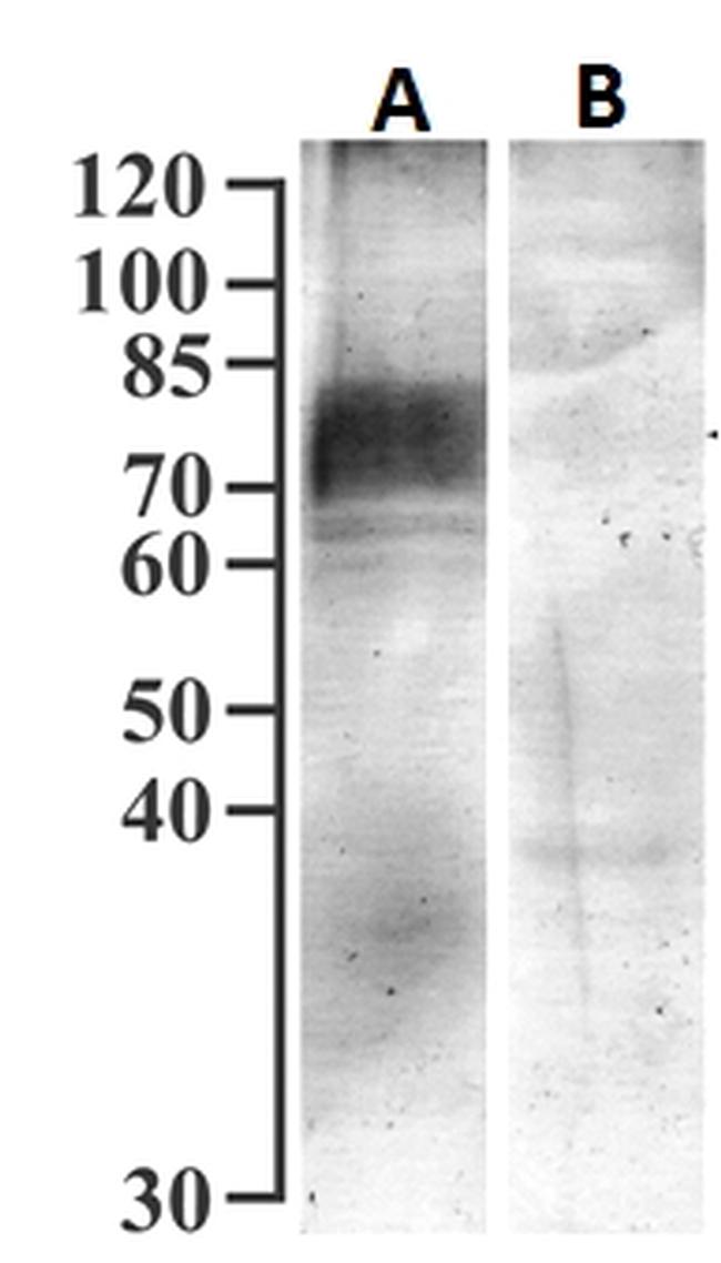 SGLT1 Antibody in Western Blot (WB)