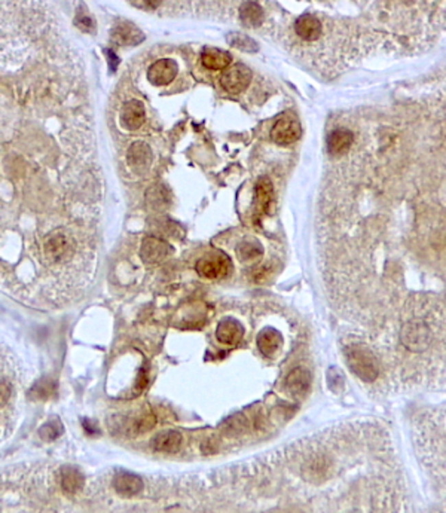 SGK1 Antibody in Immunohistochemistry (Paraffin) (IHC (P))