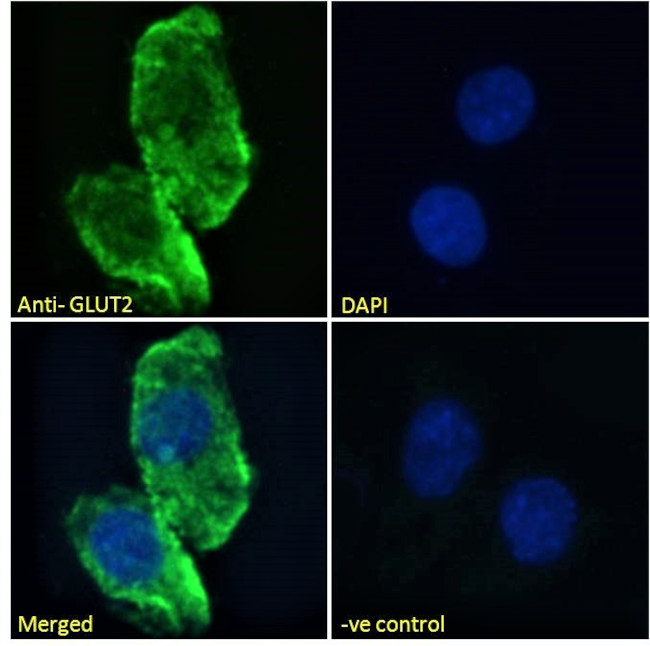 GLUT2 Antibody in Immunocytochemistry (ICC/IF)