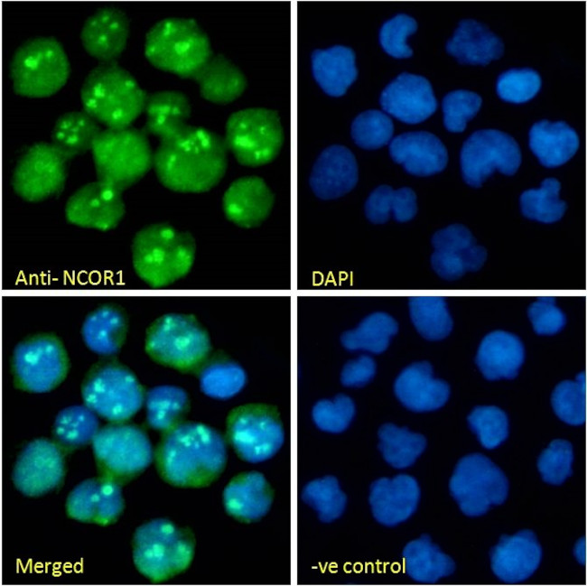 NCoR1 Antibody in Immunocytochemistry (ICC/IF)