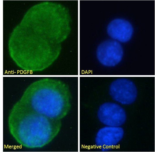 PDGF-B Antibody in Immunocytochemistry (ICC/IF)