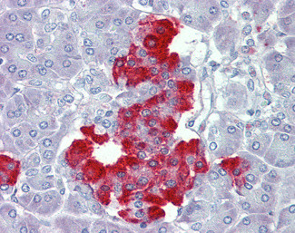 PDGF-B Antibody in Immunohistochemistry (Paraffin) (IHC (P))