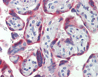 PDGF-B Antibody in Immunohistochemistry (Paraffin) (IHC (P))