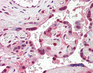 SKA3 Antibody in Immunohistochemistry (Paraffin) (IHC (P))