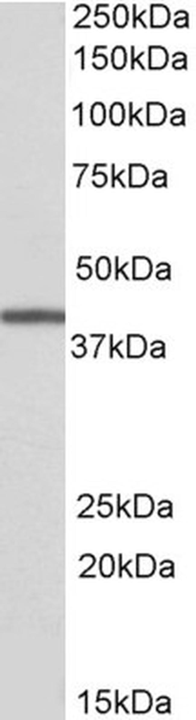 TRIB1 Antibody in Western Blot (WB)