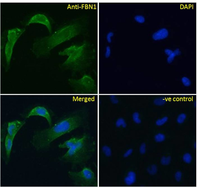 Fibrillin 1 Antibody in Immunocytochemistry (ICC/IF)