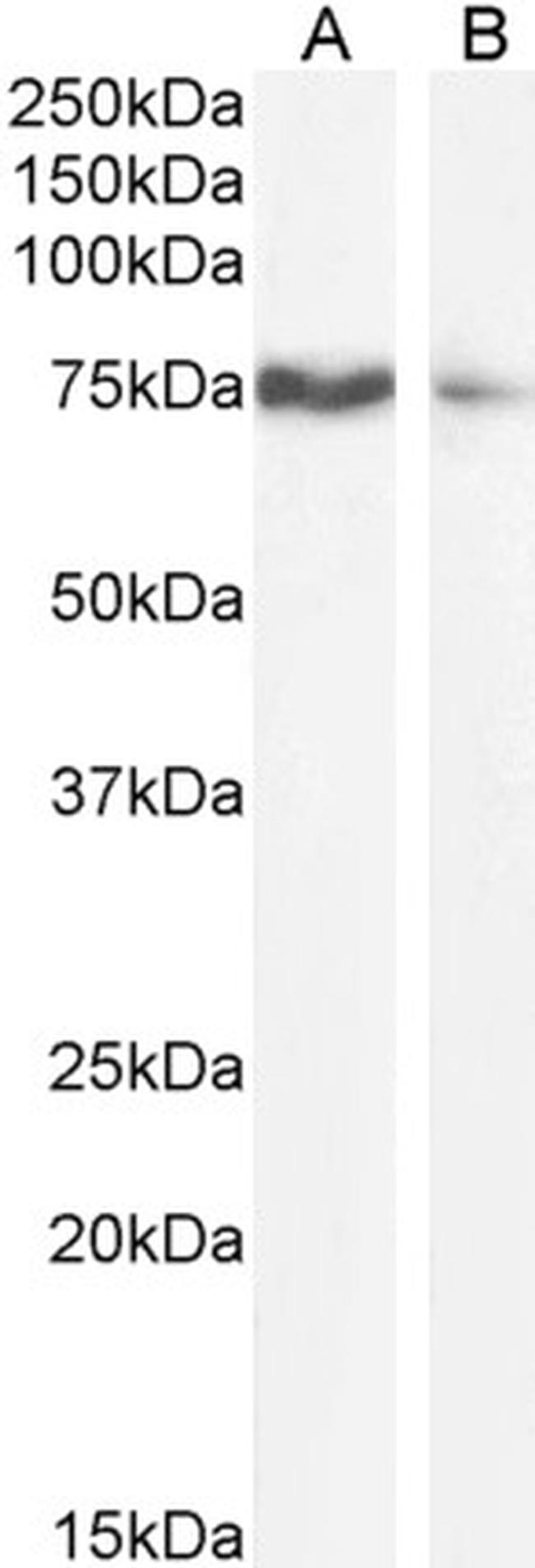 OATP8 Antibody in Western Blot (WB)