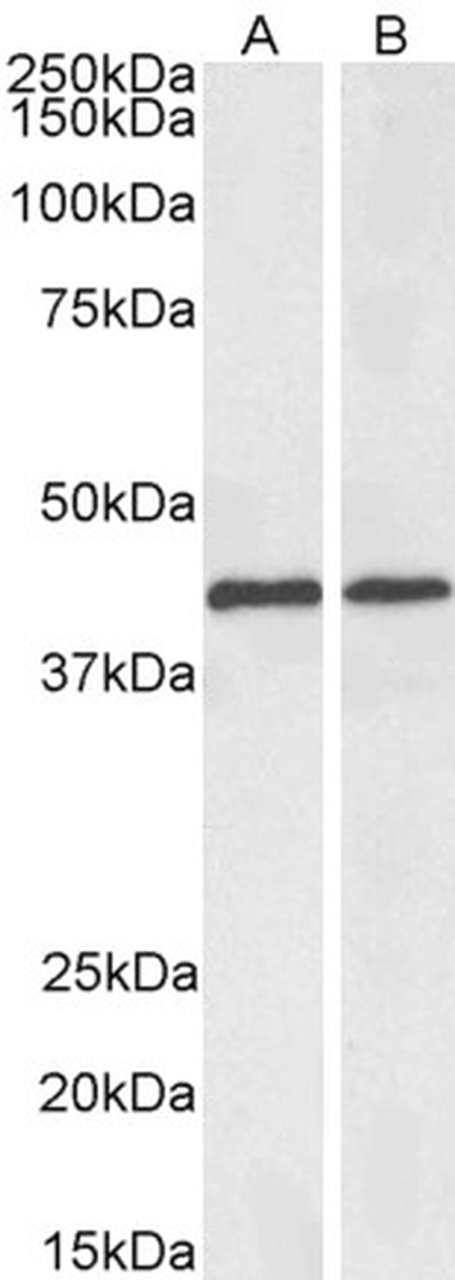 ACAT1 Antibody in Western Blot (WB)