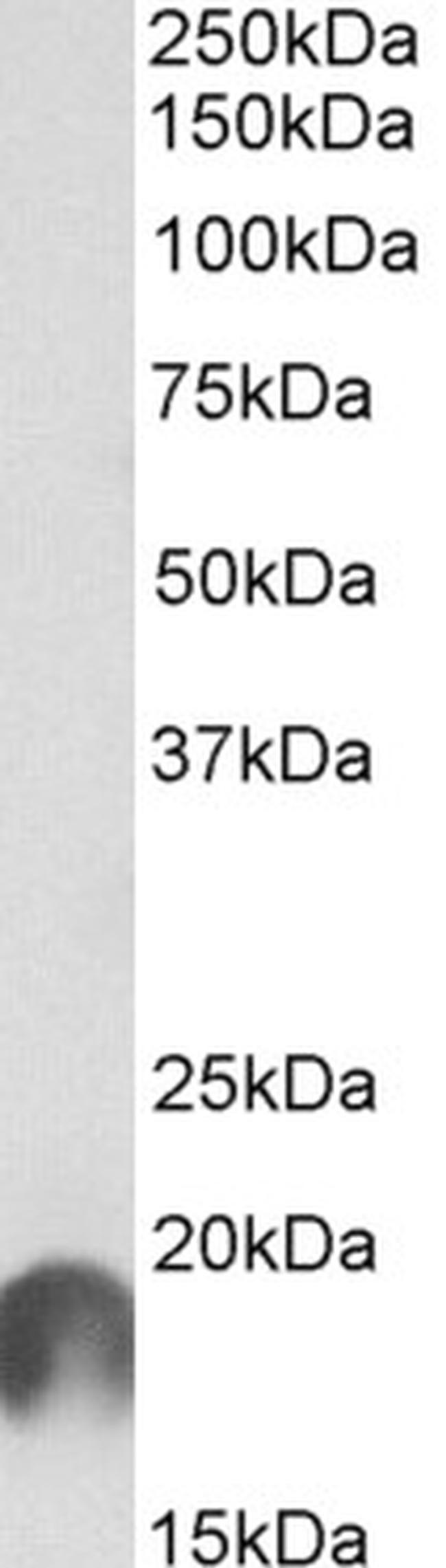 APC11 Antibody in Western Blot (WB)