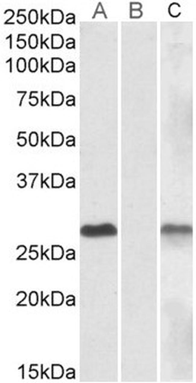 DYDC1 Antibody in Western Blot (WB)