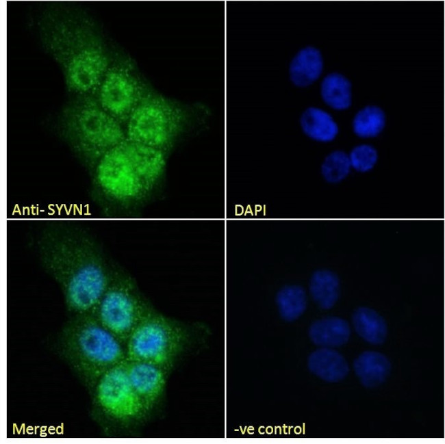 HRD1 Antibody in Immunocytochemistry (ICC/IF)