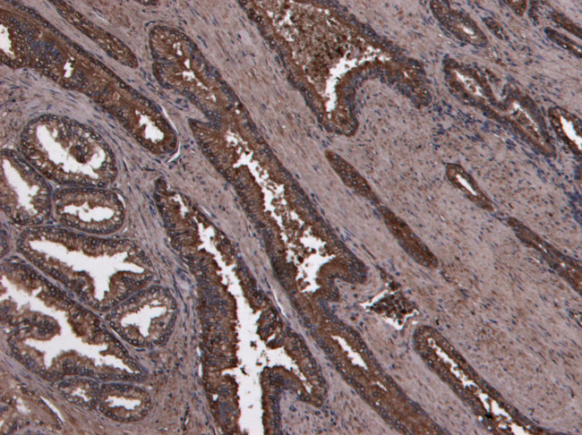 HOXD13 Antibody in Immunohistochemistry (Paraffin) (IHC (P))