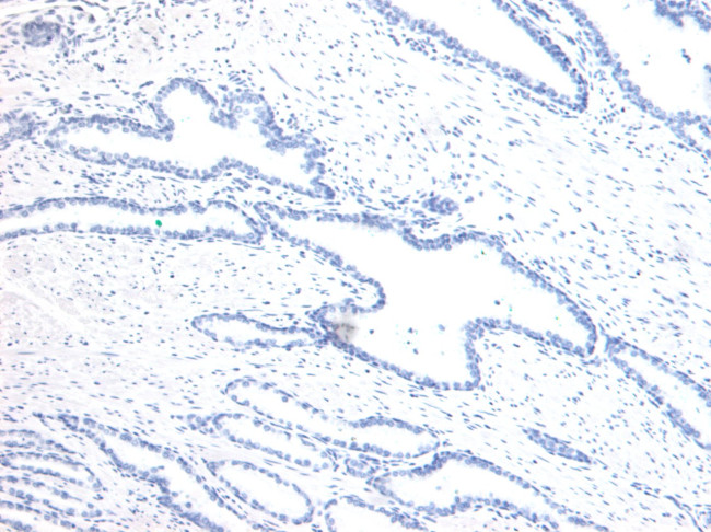 HOXD13 Antibody in Immunohistochemistry (Paraffin) (IHC (P))