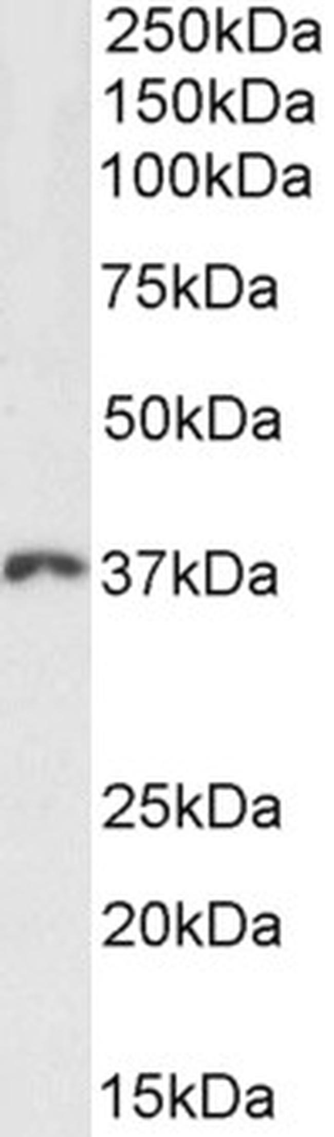 HOXD13 Antibody in Western Blot (WB)