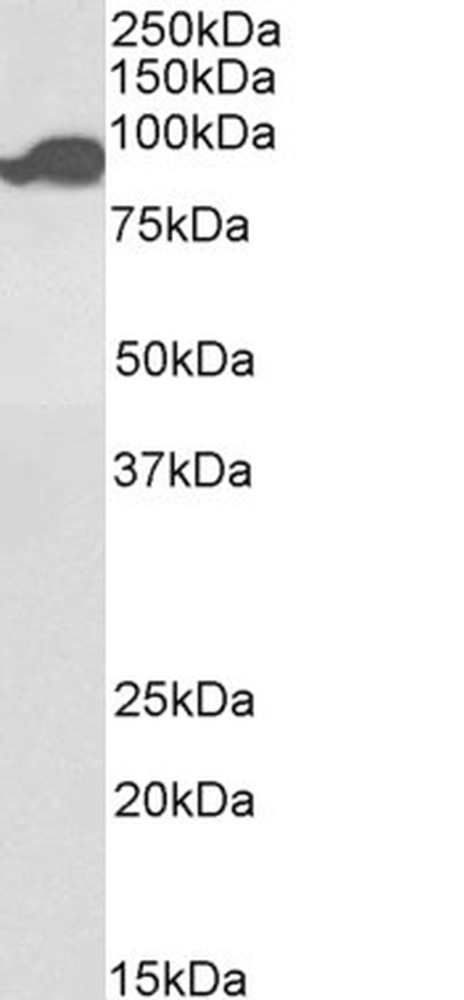 Aconitase 2 Antibody in Western Blot (WB)