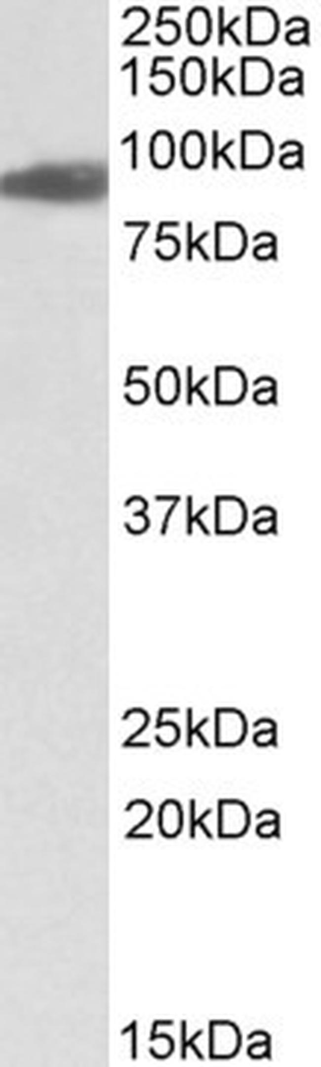 Aconitase 2 Antibody in Western Blot (WB)