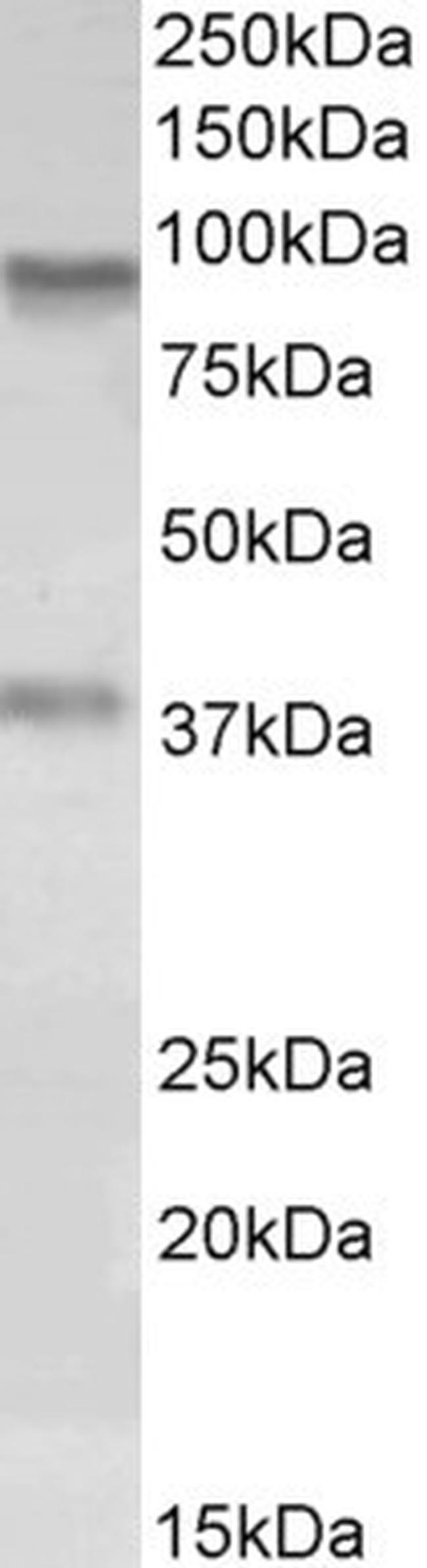 AOC3 Antibody in Western Blot (WB)