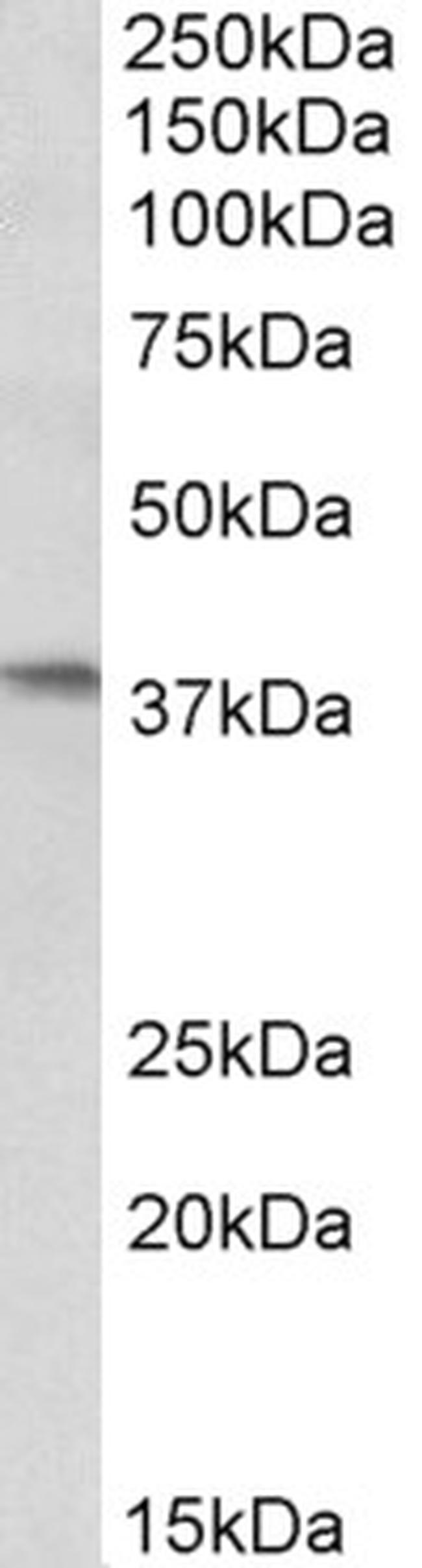 AIM2 Antibody in Western Blot (WB)