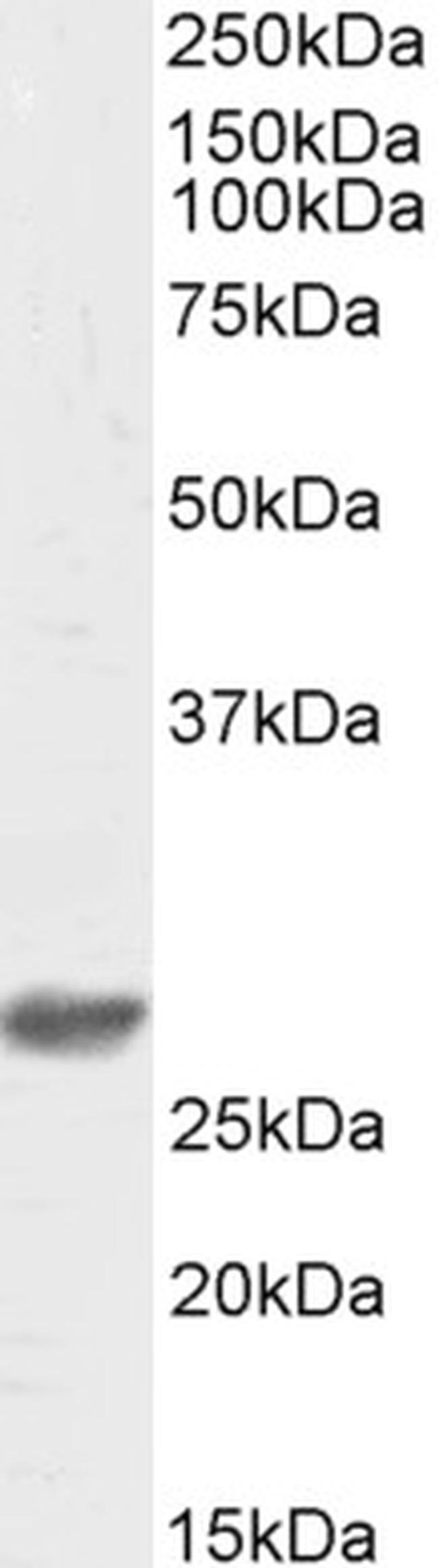 DCUN1D1 Antibody in Western Blot (WB)