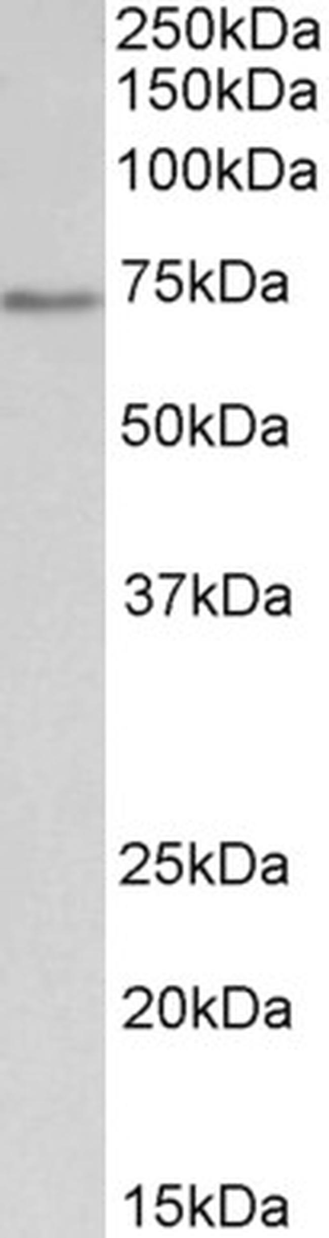 CDC6 Antibody in Western Blot (WB)