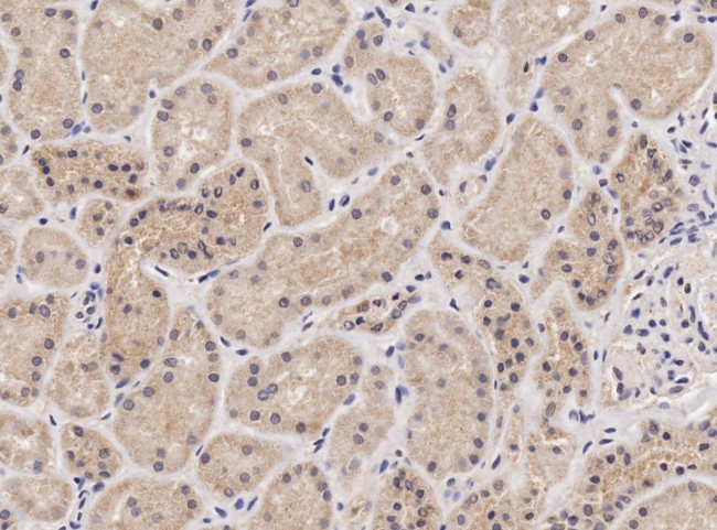 NIPBL Antibody in Immunohistochemistry (Paraffin) (IHC (P))