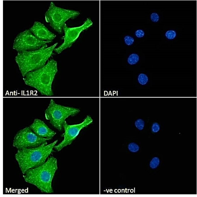 IL1R2 Antibody in Immunocytochemistry (ICC/IF)