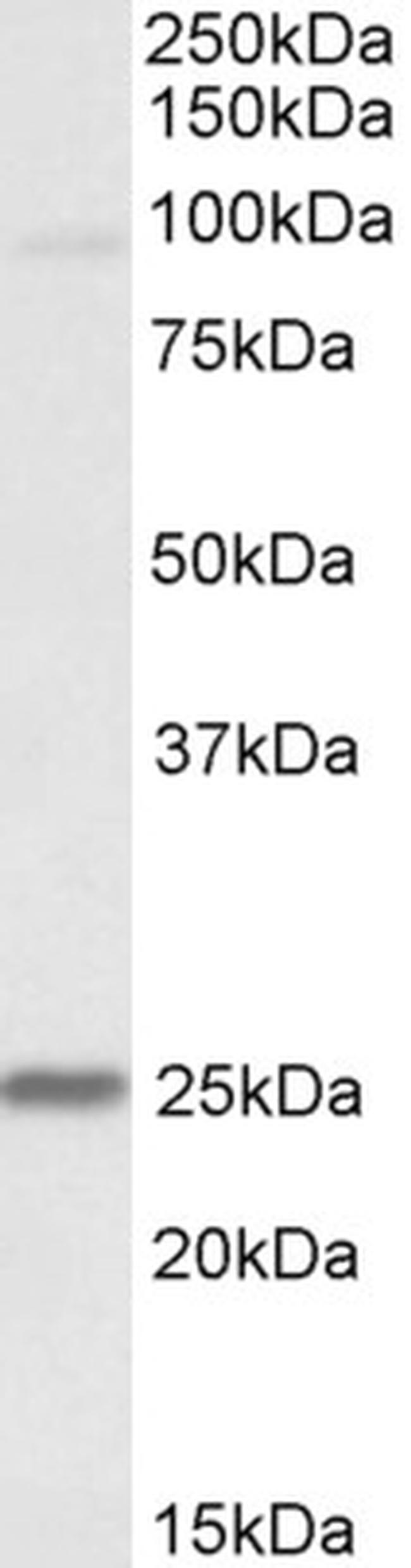 NDUFS8 Antibody in Western Blot (WB)